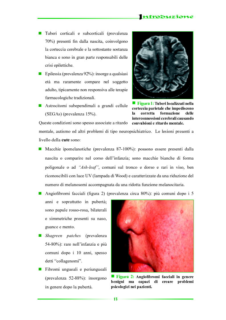 Anteprima della tesi: Espressione selettiva della survivina e sua regolazione nella Sclerosi Tuberosa, una patologia multisistemica, Pagina 8