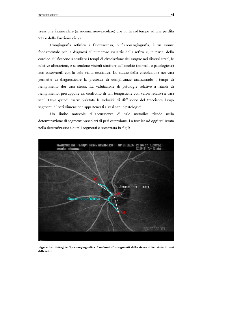 Anteprima della tesi: Identificazione del profilo vascolare in immagini fluoroangiografiche della retina tramite Active Contour Models, Pagina 3