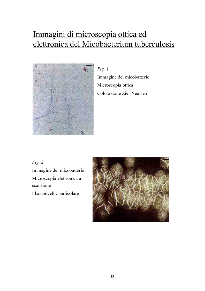 Anteprima della tesi: Immunità cellulo mediata in corso di Tubercolosi: ruolo delle cellule dendritiche, Pagina 9