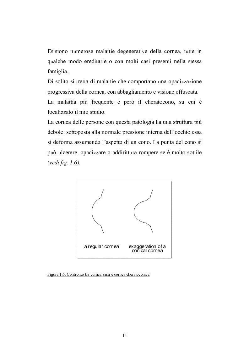 Anteprima della tesi: Studio del profilo di espressione genica in cornee sane ed in cornee affette da cheratocono., Pagina 11