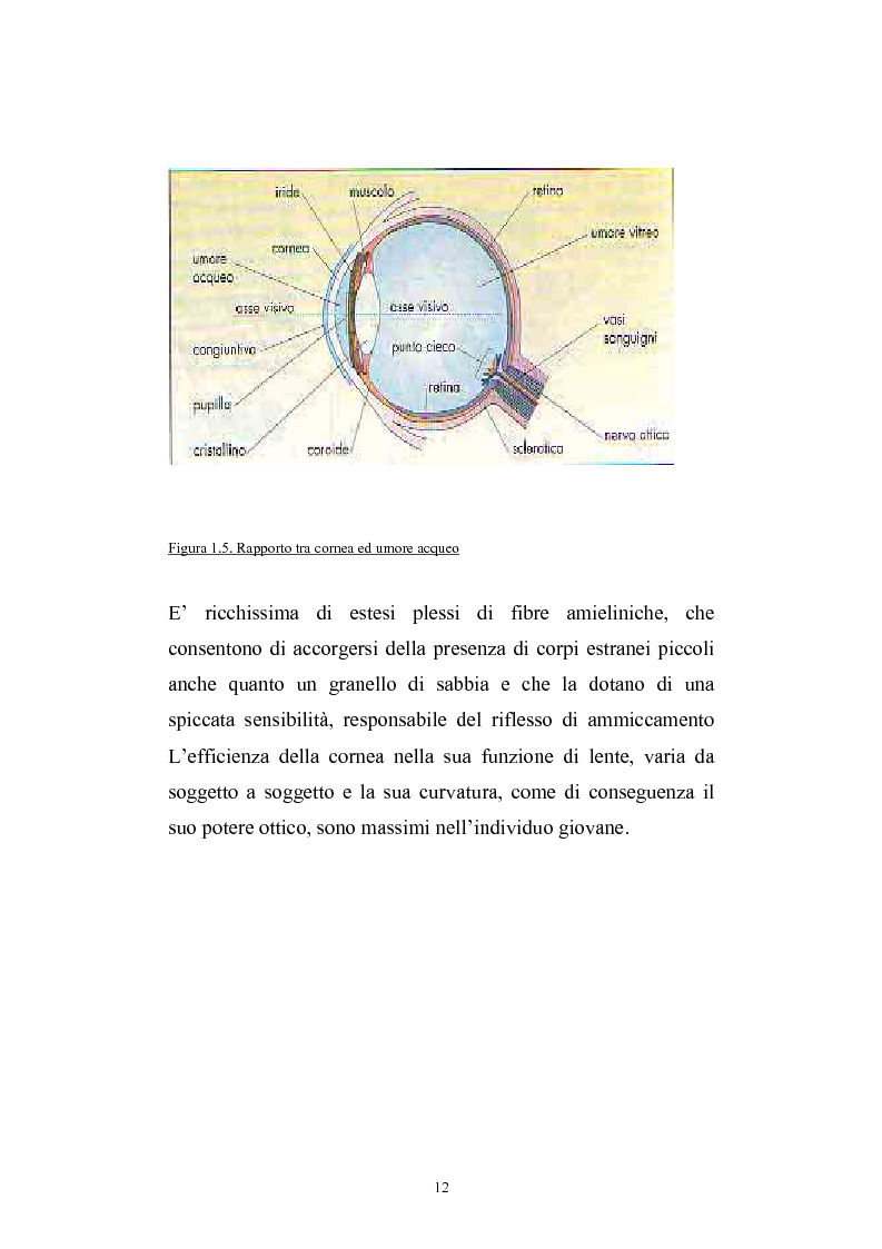 Anteprima della tesi: Studio del profilo di espressione genica in cornee sane ed in cornee affette da cheratocono., Pagina 9