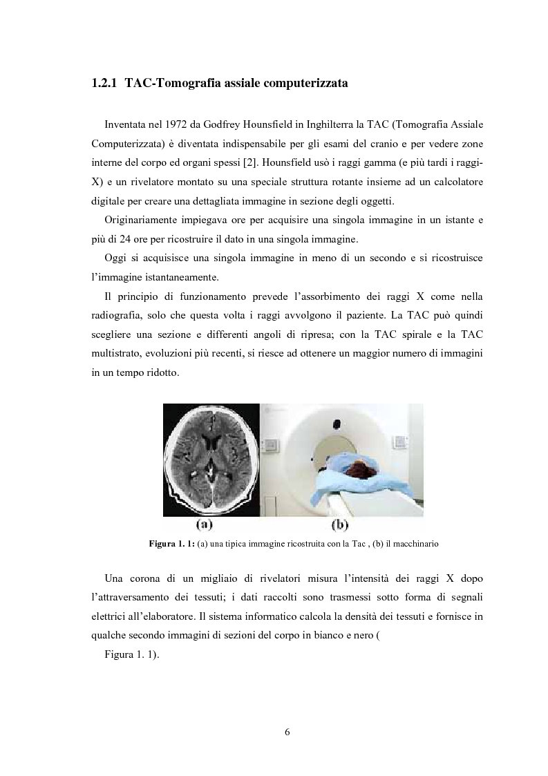 Anteprima della tesi: Studio di rivelatori a conteggio di fotoni per applicazioni medicali, Pagina 6