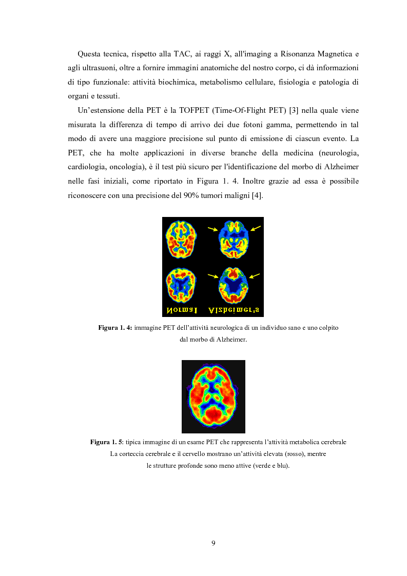 Anteprima della tesi: Studio di rivelatori a conteggio di fotoni per applicazioni medicali, Pagina 9