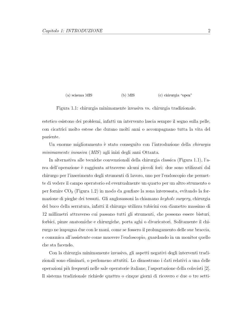 Anteprima della tesi: Chirurgia robotica minimamente invasiva: stato dell’arte e progetto di un video-laparoscopio stereo, Pagina 3