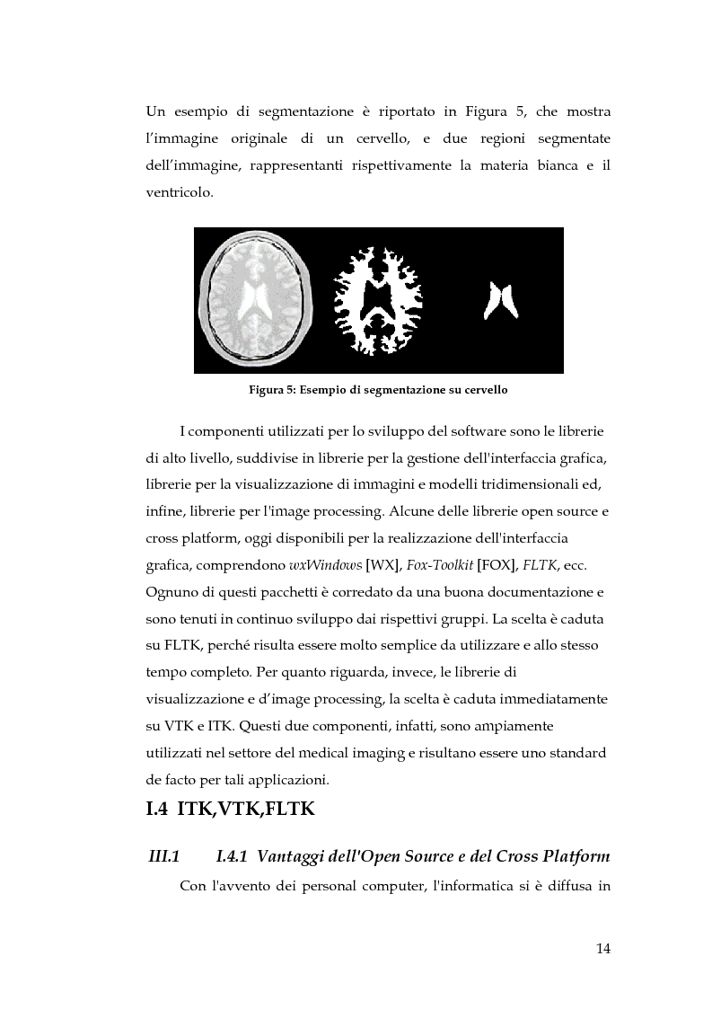 Anteprima della tesi: Realizzazione di un componente software per la segmentazione di immagini in un ambiente per il Medical Imaging, Pagina 8