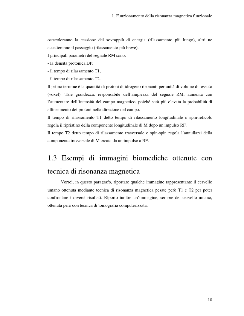 Anteprima della tesi: Un nuovo approccio di utilizzo della trasformata wavelet ridondante per l'analisi dei dati fMRI, Pagina 8