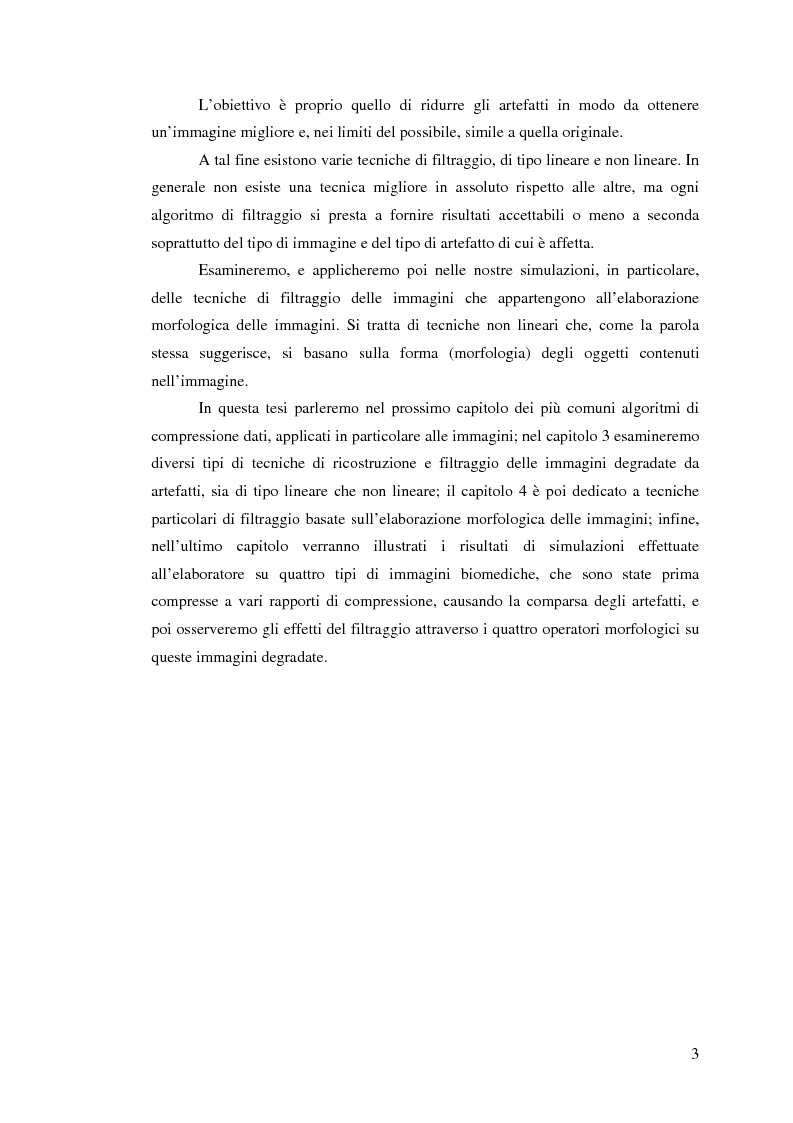 Anteprima della tesi: Elaborazione non lineare di immagini biomediche compresse mediante morfologia differenziale: studio dell'accuratezza e densità spettrale di potenza, Pagina 3