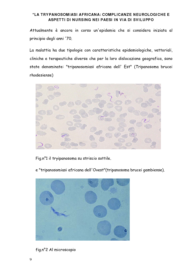 Anteprima della tesi: La trypanosomiasi africana e le complicanze neurologiche, Pagina 5