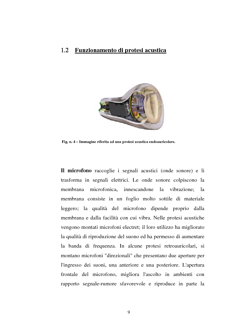 Anteprima della tesi: Protesi digitali e sistemi di riduzione del rumore ambientale, Pagina 6