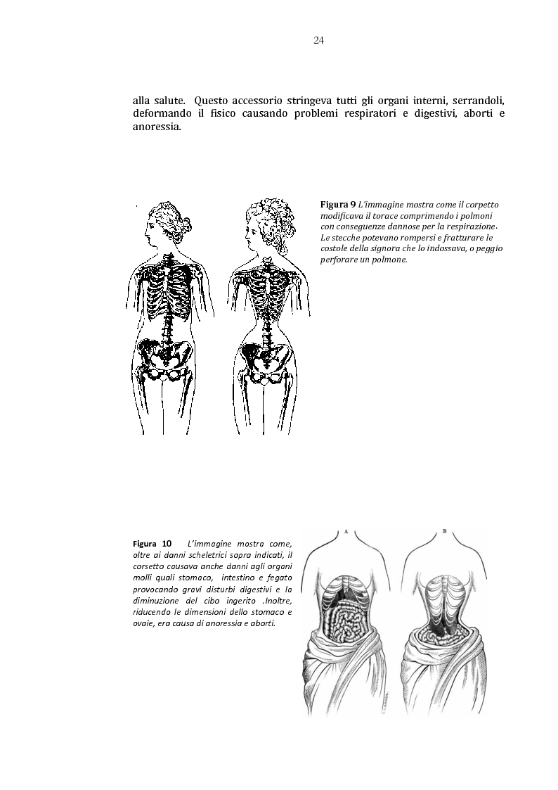 Anteprima della tesi: Danza e anoressia. L'ipotesi di Claude Lorin., Pagina 8