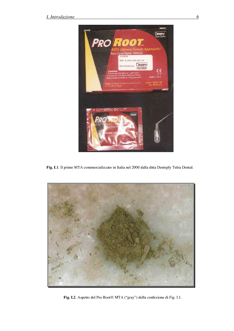 Anteprima della tesi: Il Mineral Trioxide Aggregate: analisi chimico-fisica, batteriologica e applicazioni cliniche, Pagina 4
