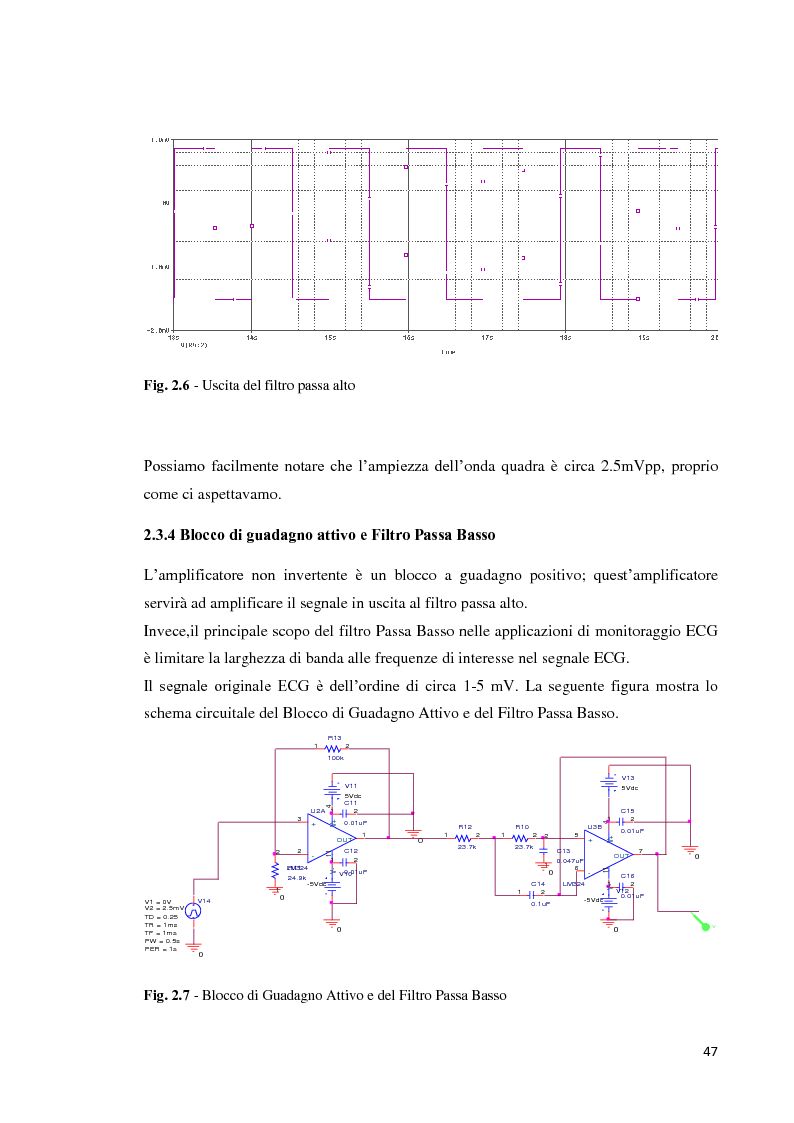 Anteprima della tesi: Implementazione e realizzazione di un sistema di misura per segnali ECG: filtraggio e simulazione, Pagina 13