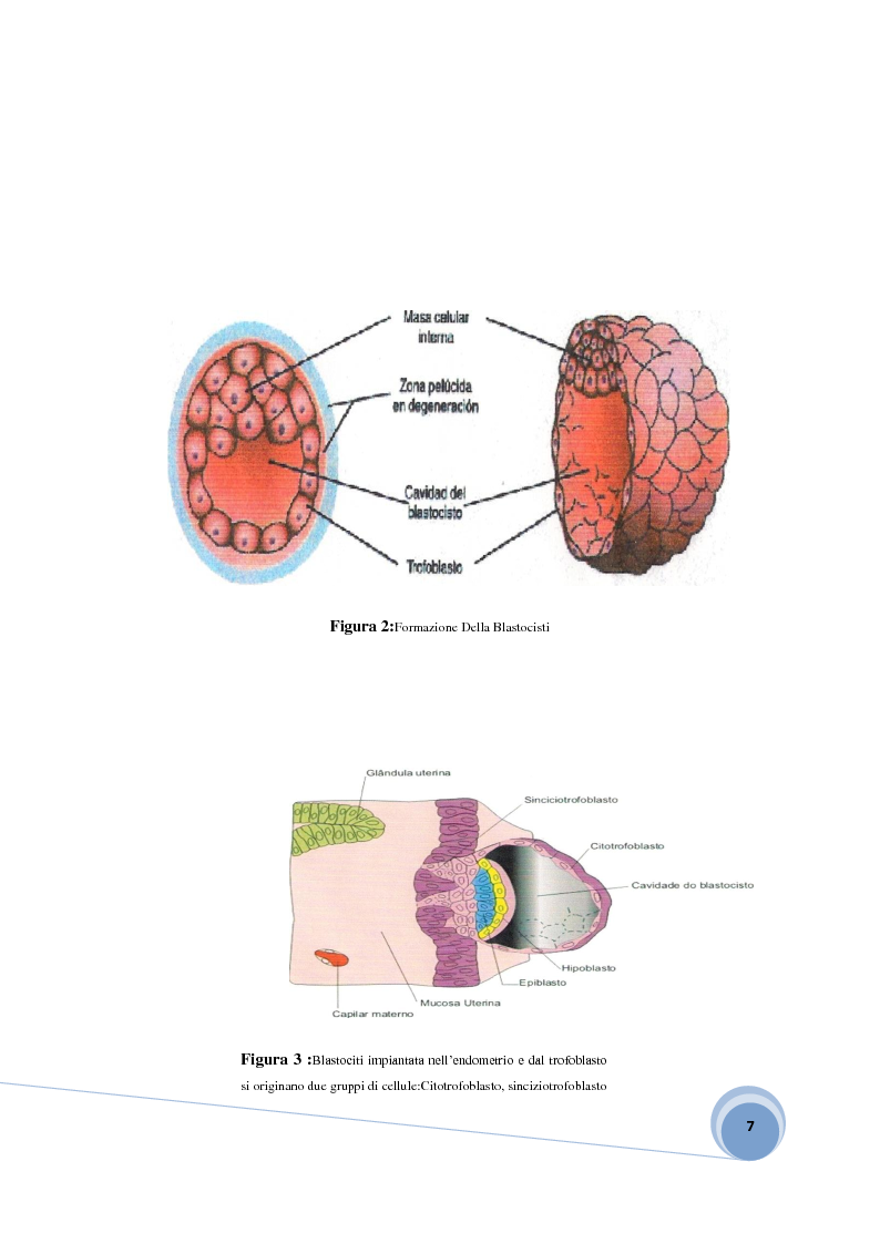 Anteprima della tesi: Fisiopatologia e aspetto immunoistochimico della mola vescicolare, Pagina 5