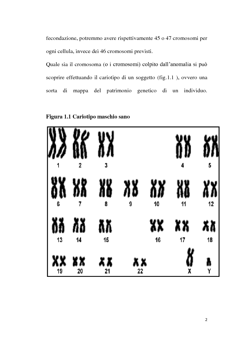 Anteprima della tesi: Patogenesi molecolare della Sindrome di Down, Pagina 3