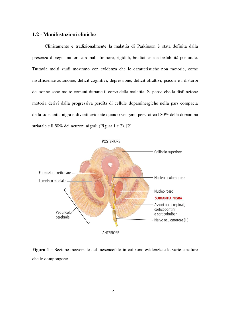 Anteprima della tesi: Fattori di rischio genetici e ambientali nella malattia di Parkinson, Pagina 3