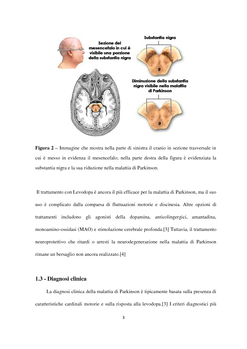 Anteprima della tesi: Fattori di rischio genetici e ambientali nella malattia di Parkinson, Pagina 4