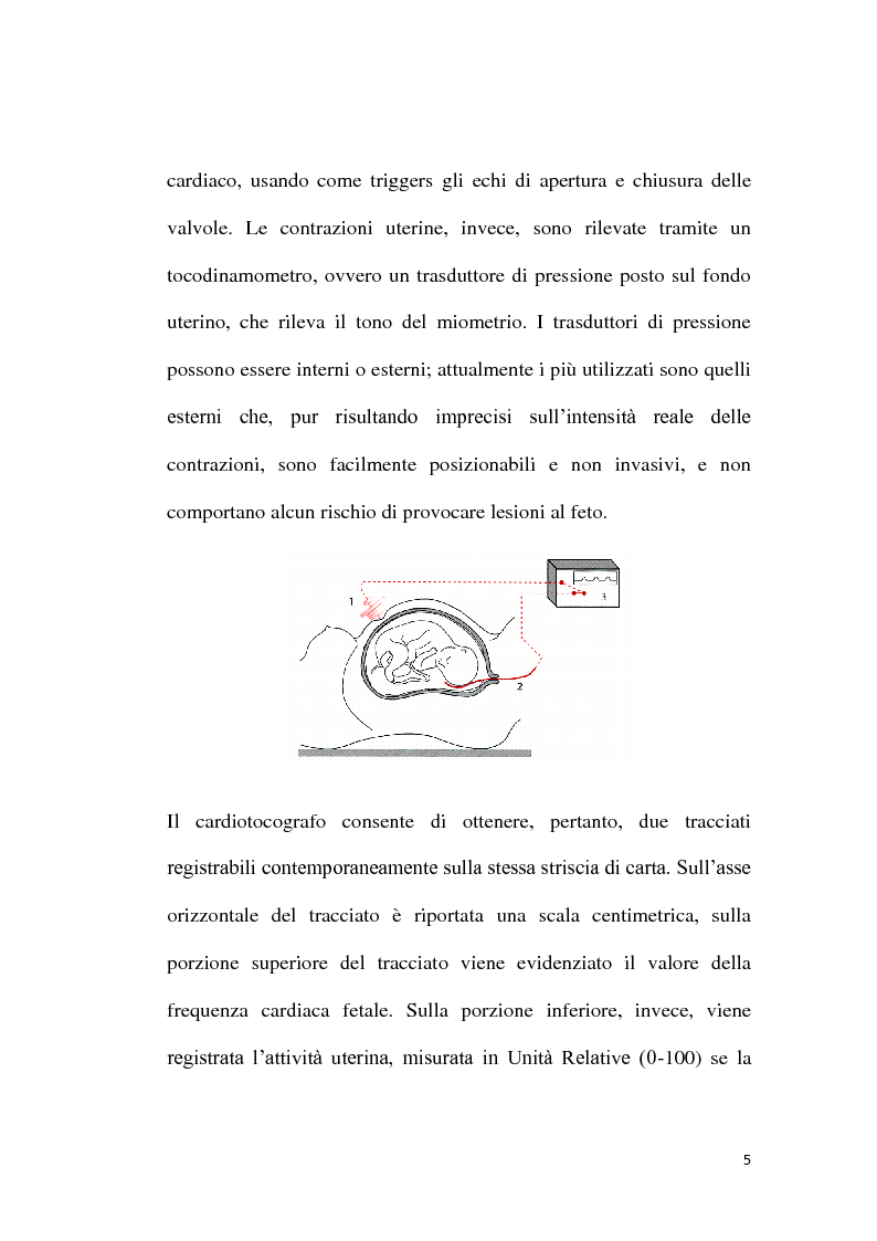 Anteprima della tesi: Responsabilità e competenze professionali dell'Ostetrica nella rilevazione e valutazione del tracciato cardiotocografico: analisi dei contenziosi medico legali, Pagina 6