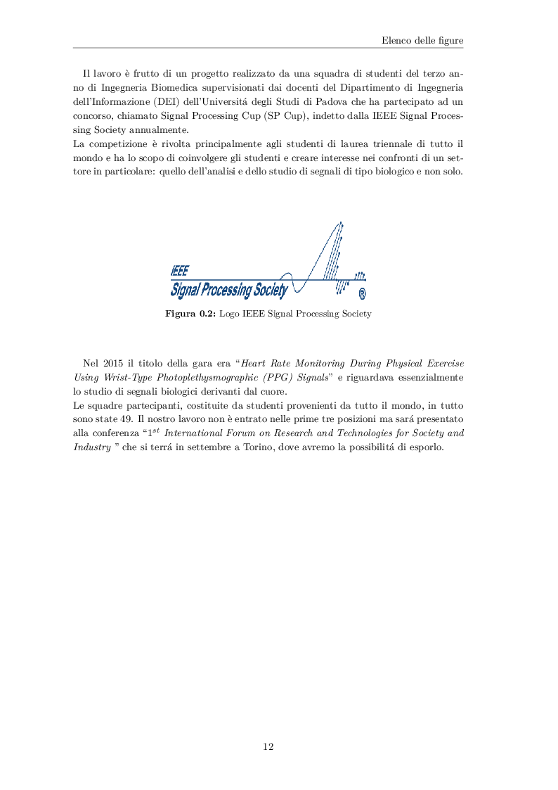 Anteprima della tesi: Analisi spettrale di un segnale fotopletismografico (PPG) per lo sviluppo di un algoritmo di stima del battito cardiaco basato sul filtro di Kalman, Pagina 4