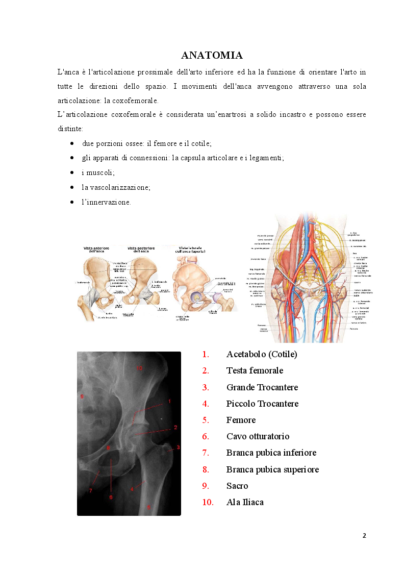 Anteprima della tesi: Strategie cliniche nelle fratture del collo femore dell'anziano: confronto tra due metodiche chirurgiche, Pagina 3