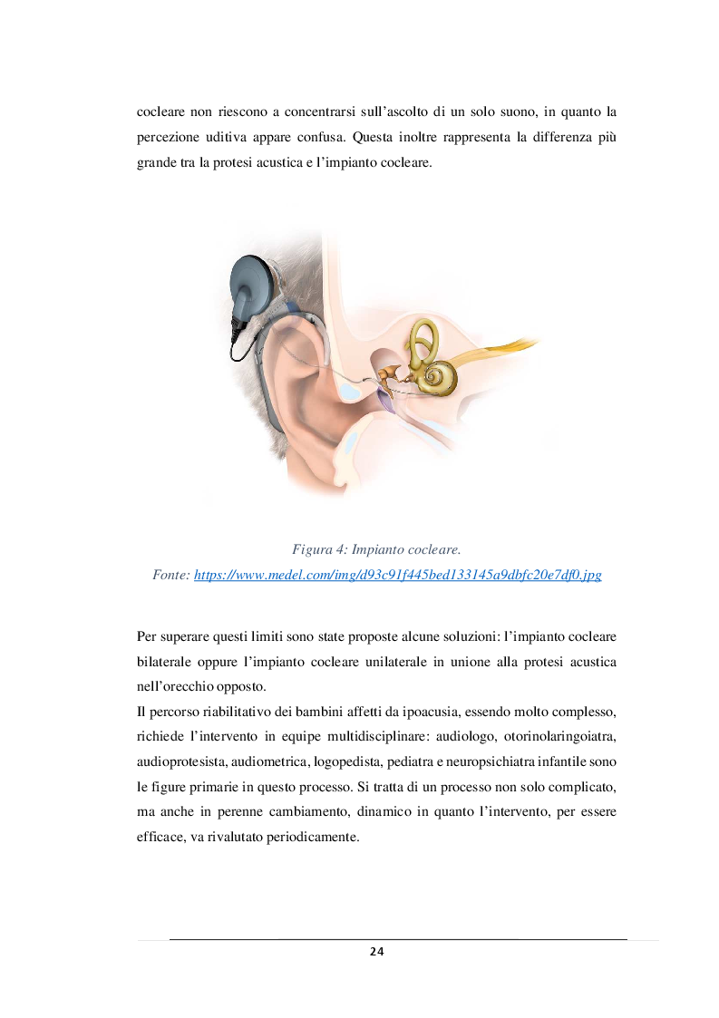Anteprima della tesi: L'inclusione della persona con disabilità uditiva, Pagina 5