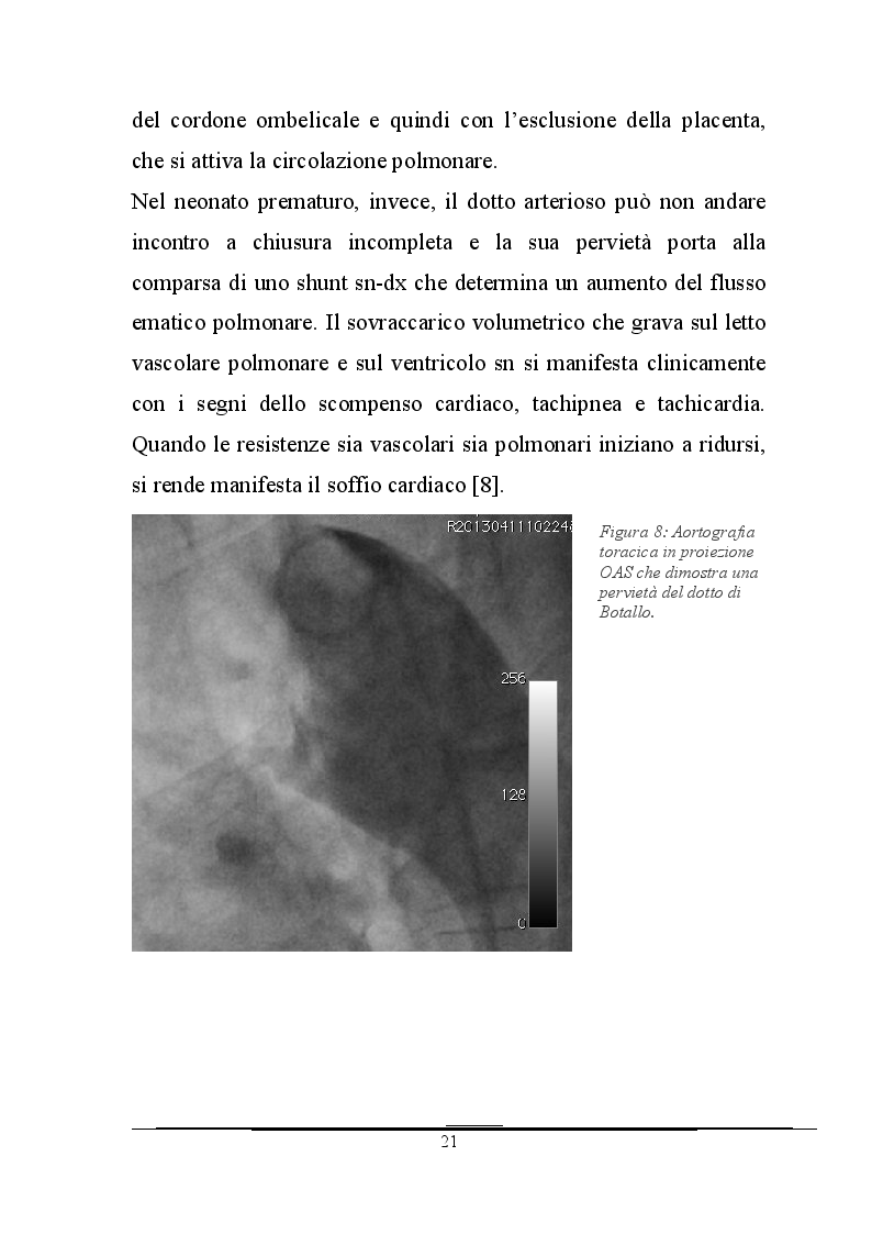 Anteprima della tesi: Work-up d'imaging nelle cardiopatie congenite dell'adulto, Pagina 10