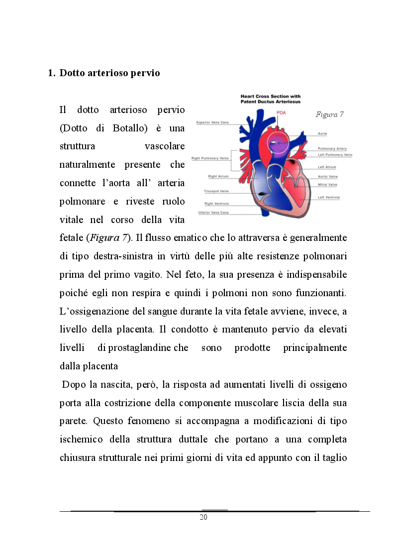 Anteprima della tesi: Work-up d'imaging nelle cardiopatie congenite dell'adulto, Pagina 9