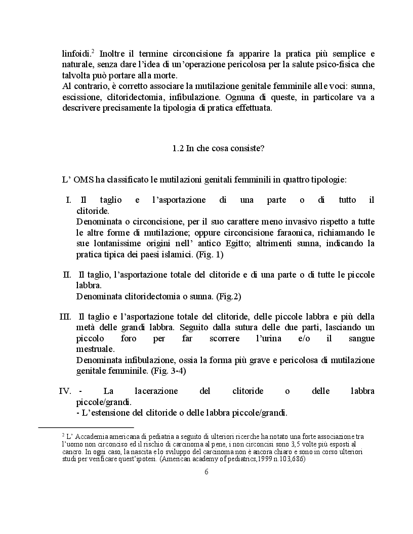 Anteprima della tesi: Tra religione e cultura: la mutilazione genitale femminile, Pagina 4