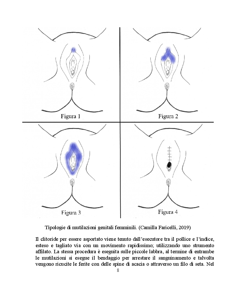 Anteprima della tesi: Tra religione e cultura: la mutilazione genitale femminile, Pagina 6