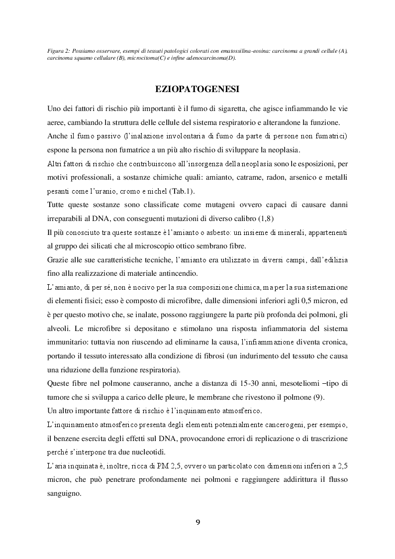 Estratto dalla tesi: Valutazione della caratterizzazione di tumori polmonari tramite metodica FISH
