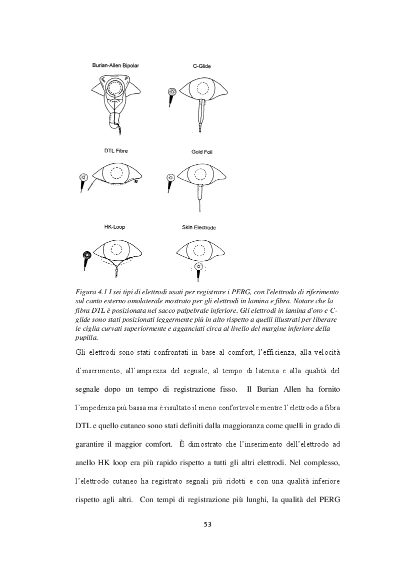 Anteprima della tesi: Tipologie di elettrodi impiegati negli esami elettrofisiologici nell'adulto e nel bambino, Pagina 4