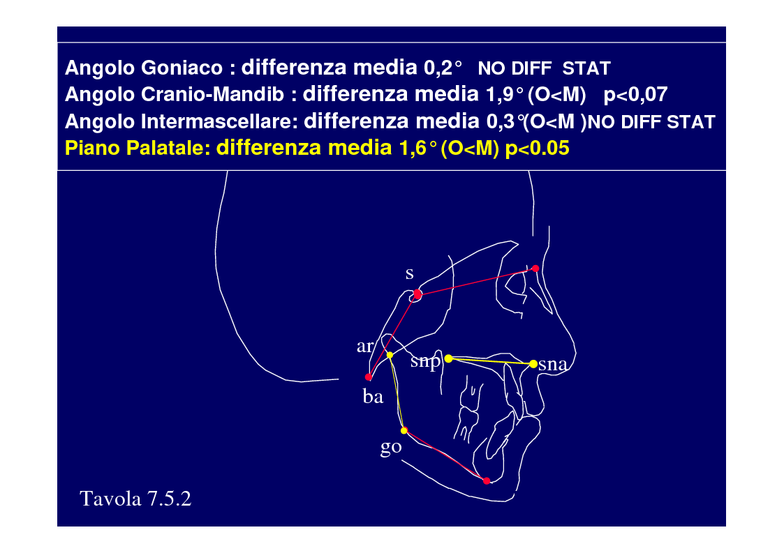 Anteprima della tesi: La crescita cranio-facciale nei pazienti affetti da labiopalatoschisi monolaterale completa: studio multicentric, Pagina 13