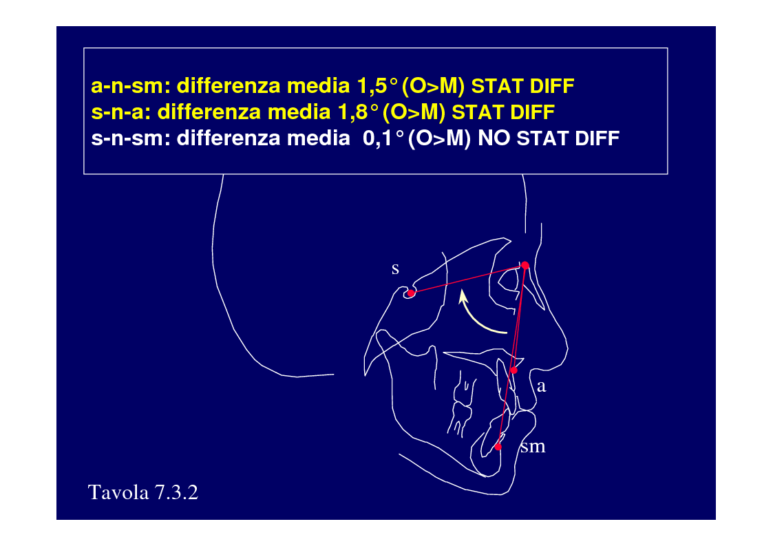 Anteprima della tesi: La crescita cranio-facciale nei pazienti affetti da labiopalatoschisi monolaterale completa: studio multicentric, Pagina 9