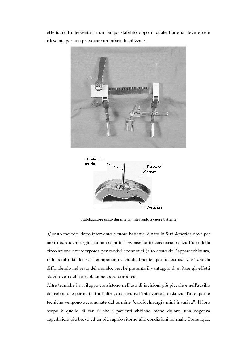 Anteprima della tesi: Sviluppo di un dispositivo ad infrarossi per misure in vivo di temperatura per applicazioni cardiochirurgiche, Pagina 10