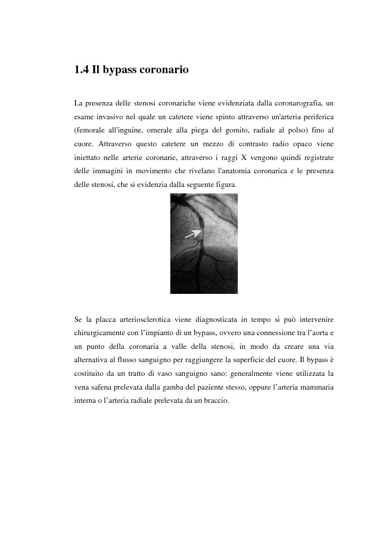 Anteprima della tesi: Sviluppo di un dispositivo ad infrarossi per misure in vivo di temperatura per applicazioni cardiochirurgiche, Pagina 8
