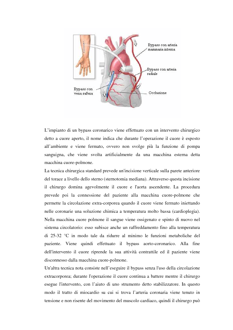 Anteprima della tesi: Sviluppo di un dispositivo ad infrarossi per misure in vivo di temperatura per applicazioni cardiochirurgiche, Pagina 9