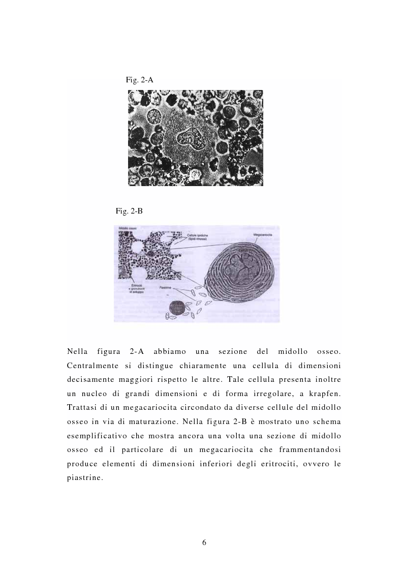 Anteprima della tesi: Porpora Trombocitopenica Idiopatica, Pagina 6