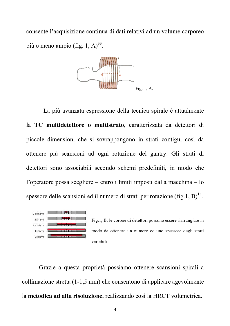 Anteprima della tesi: TC spirale ad alta risoluzione nello studio del parenchima polmonare, Pagina 4
